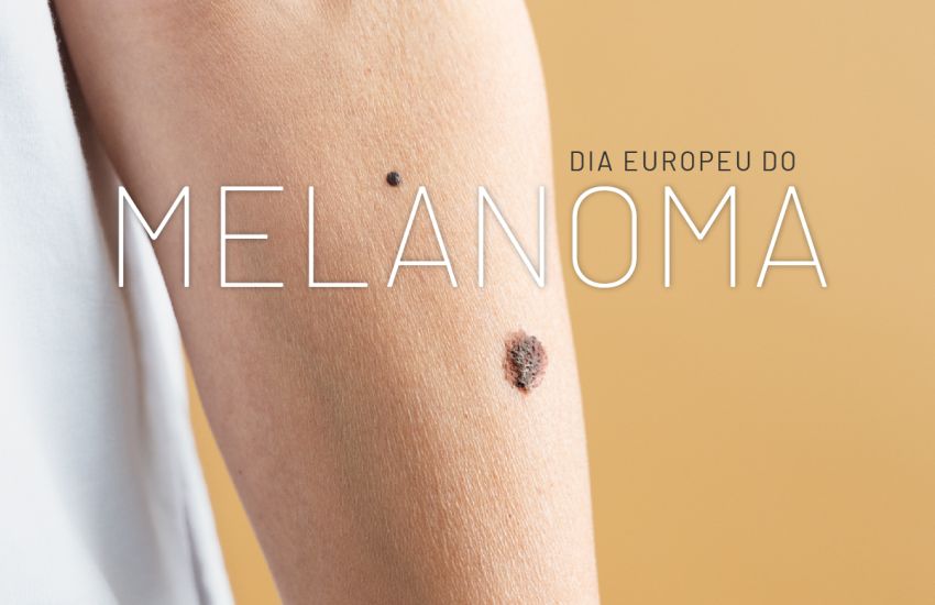 #diaeuropeudomelanoma